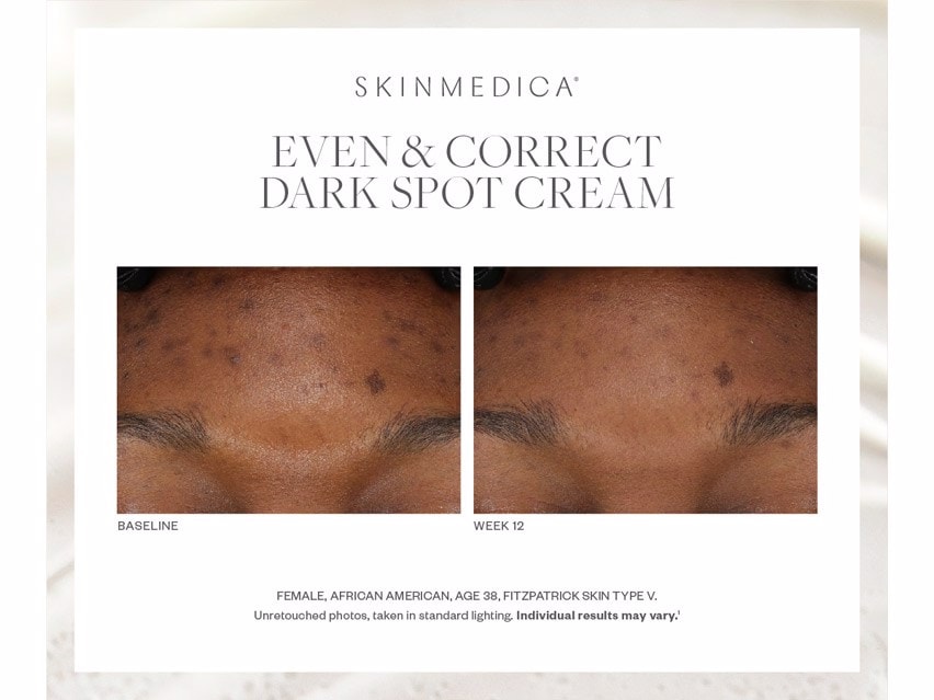 SkinMedica Even & Correct Dark Spot Cream