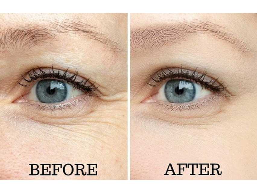 Osmotics Under Eye Rejuvenator