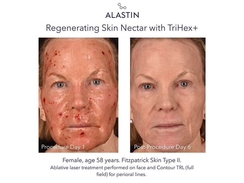 ALASTIN Skincare Regenerating Skin Nectar with TriHex+