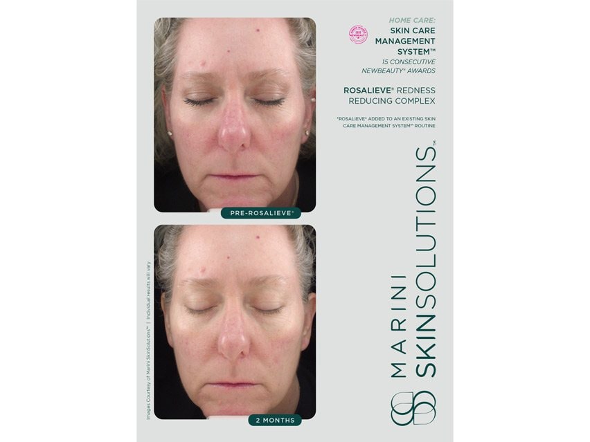 Marini SkinSolutions RosaLieve® Redness Reducing Complex Face Lotion