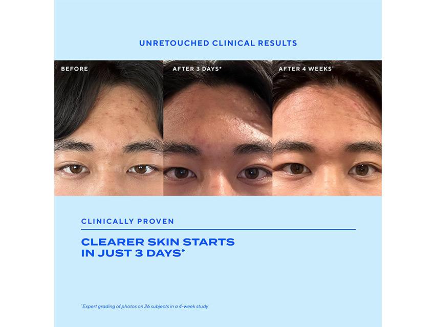 Murad Biome-Balancing Clear &amp; Prevent Acne Treatment Serum