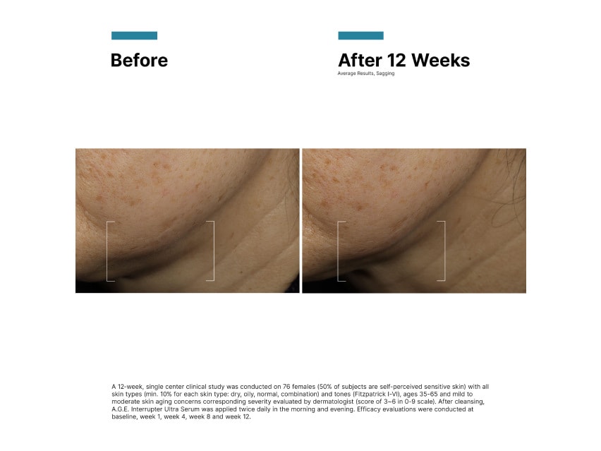 SkinCeuticals A.G.E. Interrupter Ultra Serum