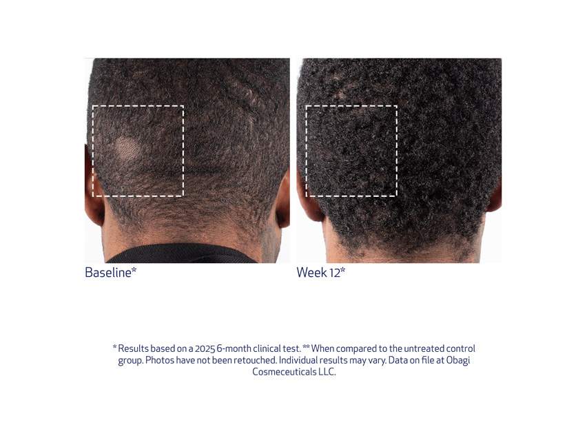 Obagi Nu-Cil BioStim Scalp Serum