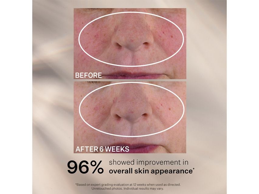 StriVectin Advanced Retinol Nightly Multi-Correct Serum