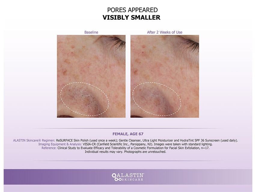 ALASTIN Skincare ReSURFACE Skin Polish