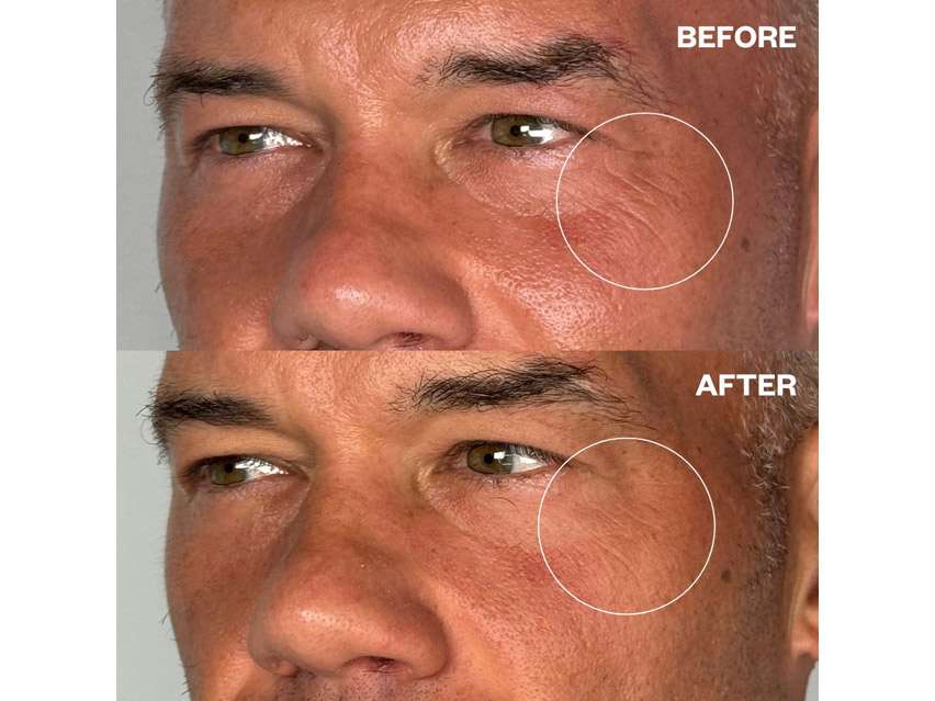 Wrinkles Schminkles Men's Pro Eye Wrinkle Patches