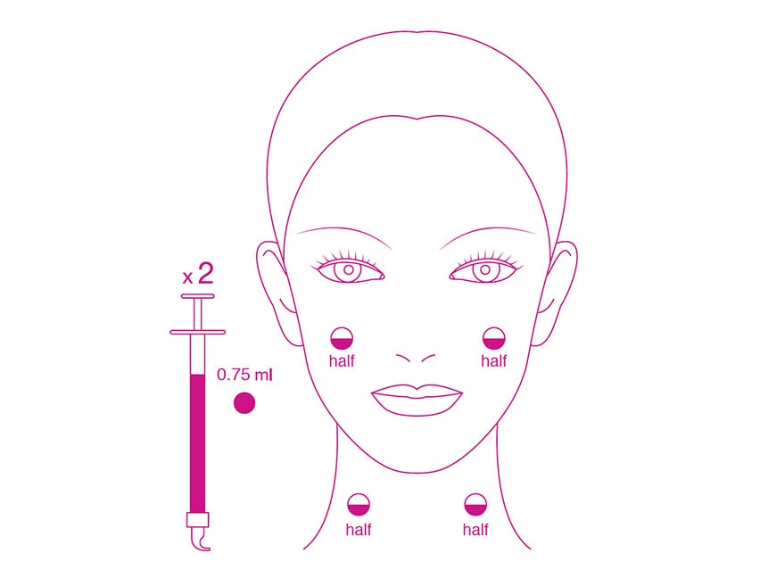 Fillerina Facial Lifting Treatment - Grade 1