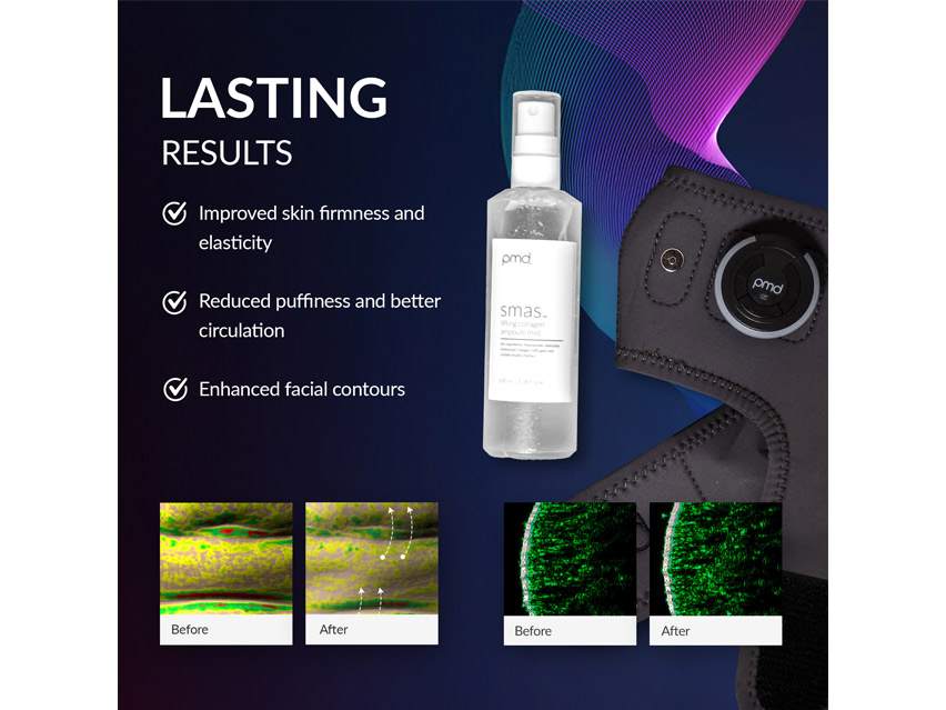 PMD SMAS Lifting Massage Band