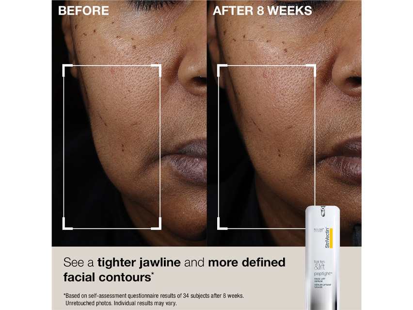 StriVectin Tighten &amp; Lift Face &amp; Neck Solution Set - Limited Edition
