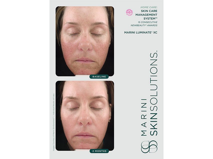 Marini SkinSolutions Marini Luminate XC Face Lotion