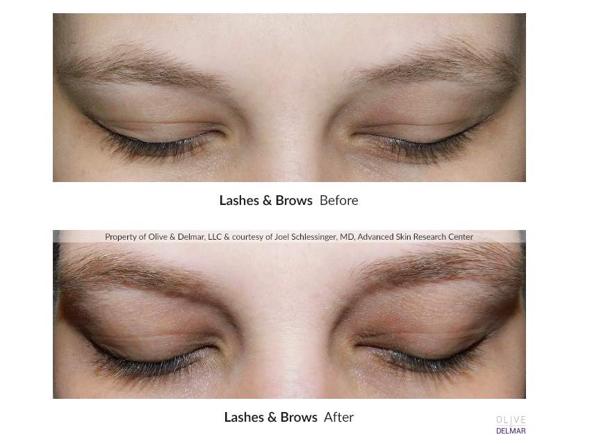 neuBROW PROFESSIONAL™ by Skin Research Professional (Brow Enhancing Serum)