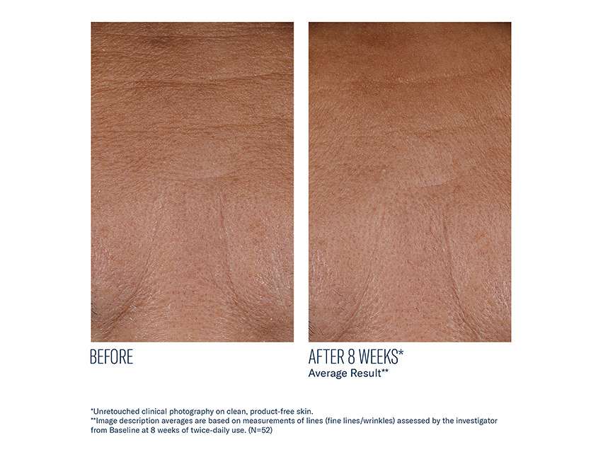 skinbetter science InterFuse Treatment Cream FACE &amp; NECK