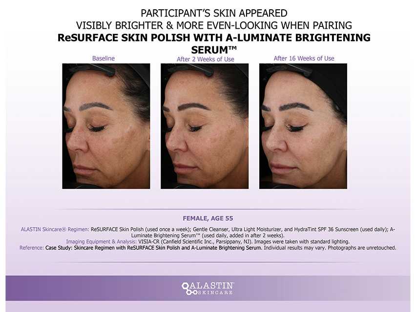 ALASTIN Skincare ReSURFACE Skin Polish