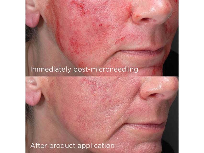 IMAGE Skincare DAILY PREVENTION Advanced Smartblend Mineral Moisturizer SPF 75