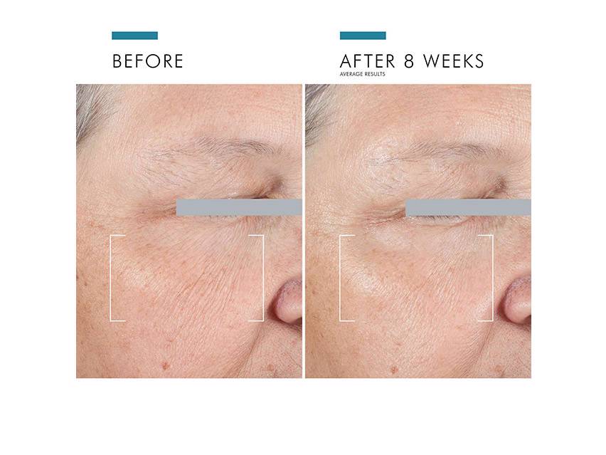 SkinCeuticals A.G.E. Advanced Eye Cream Before and After results