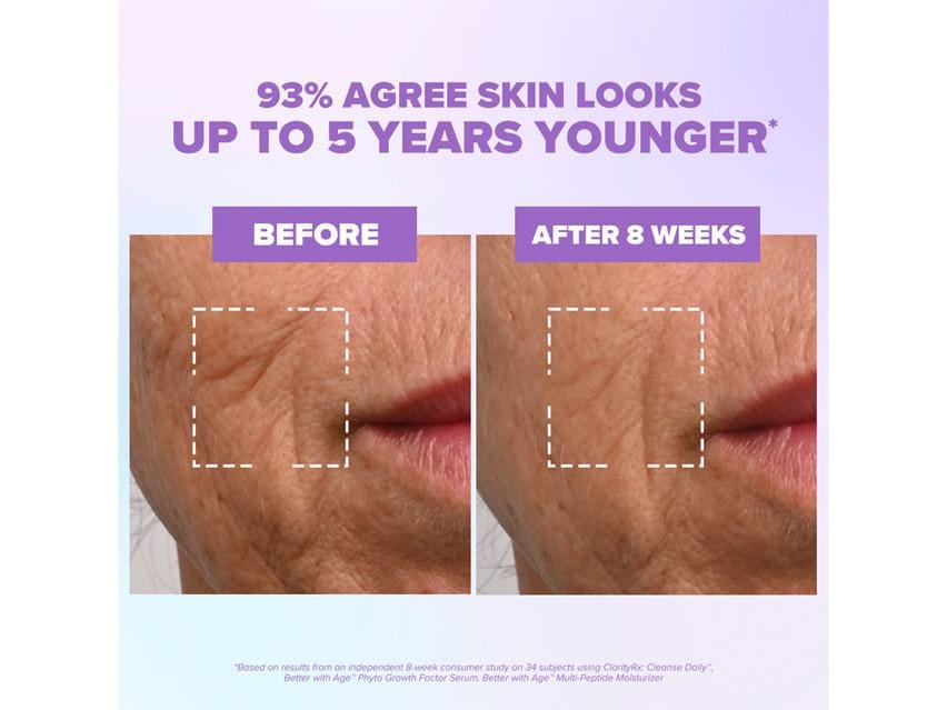 ClarityRx Better With Age Phyto Growth Factor Serum