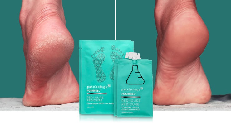 How To Get Smooth Feet: Natasha’s Experience with patchology PoshPeel Pedicure