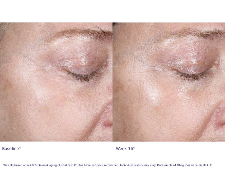 Obagi Professional-C 20% Vitamin C Antioxidant Serum
