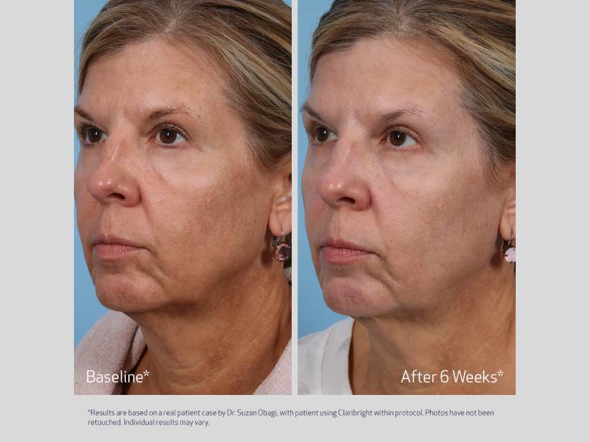 SUZANOBAGIMD Claribright Radiance Brightening Lotion