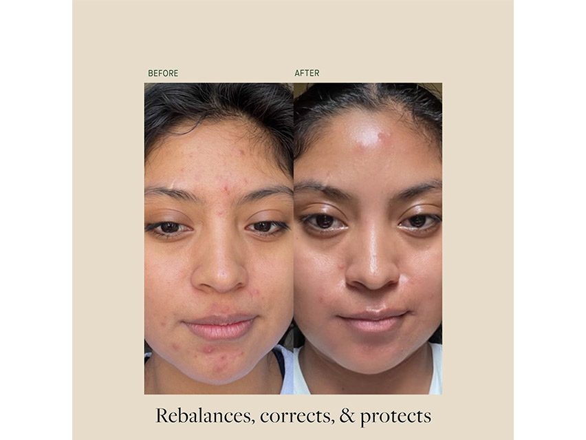 Kat Burki VitaBiome Active Skin Optimizer