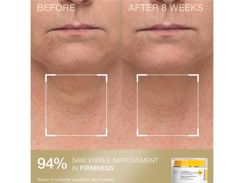 StriVectin Contour &amp; Tighten Kit - Limited Edition