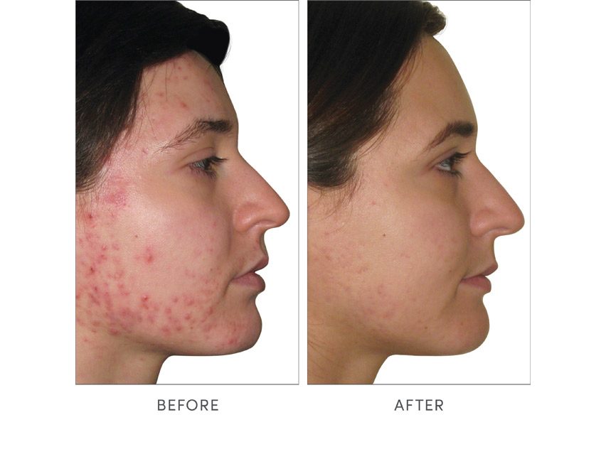 jane iredale Skin Accumax Dietary Supplement