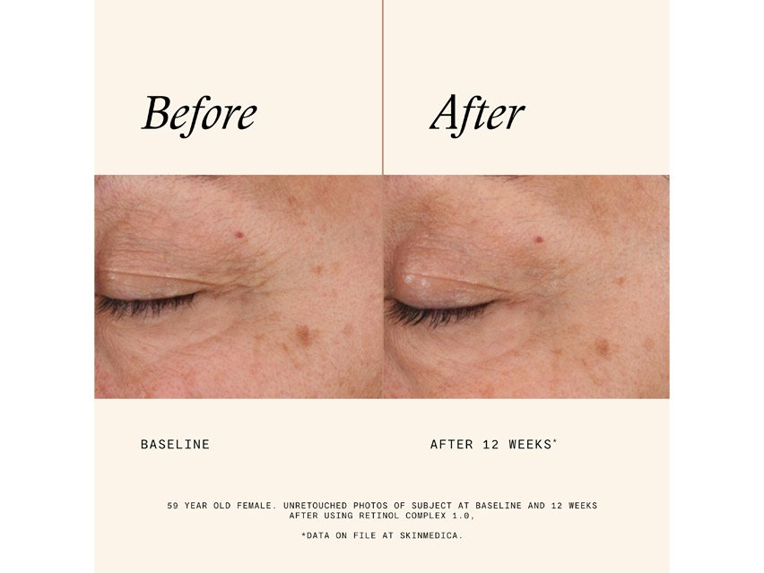 SkinMedica Retinol Complex 0.5