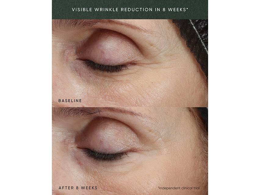 Irene Forte Phytomelatonin Rejuvenating Eye Cream