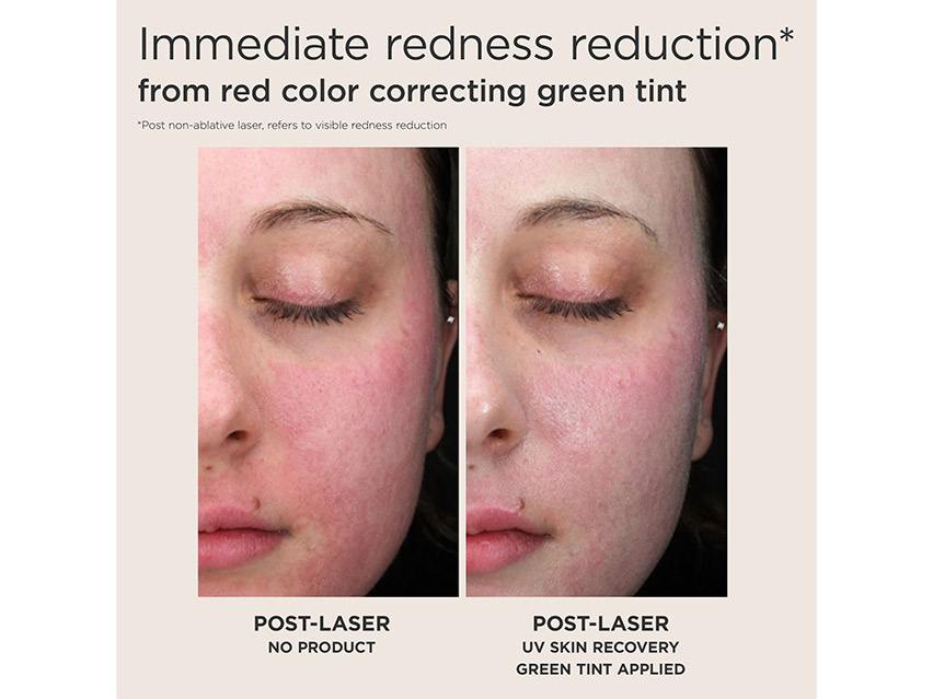 EltaMD UV Skin Recovery Broad Spectrum SPF 50 - Green Tint for Redness