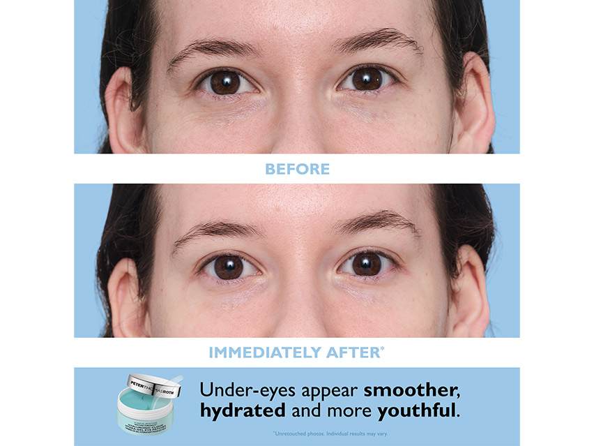 Peter Thomas Roth Vitamin C &amp; Hyaluronic Eye Patch Set - Limited Edition