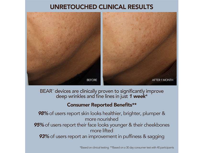 FOREO SUPERCHARGED Microcurrent Facelift Set