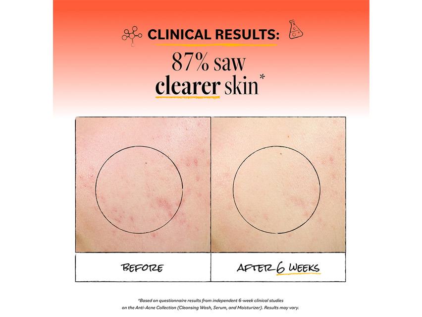 derma e Anti-Acne Acne Deep Pore Cleansing Wash