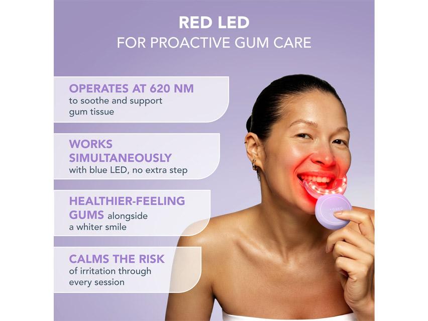 FOREO ISSA Teeth Whitening Set