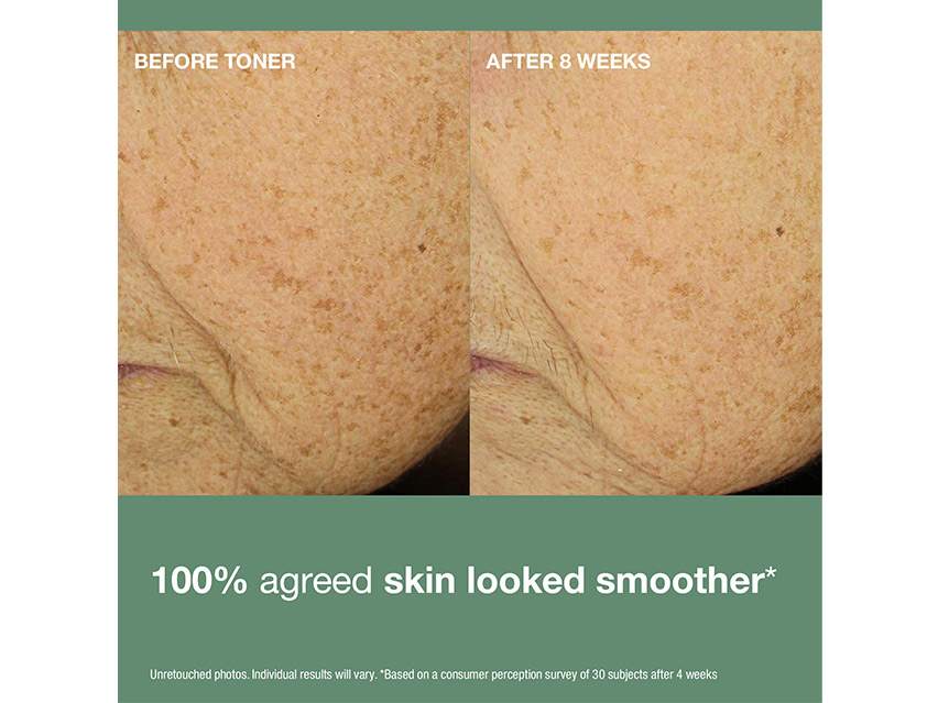 StriVectin Daily Reveal Texturizing Toner