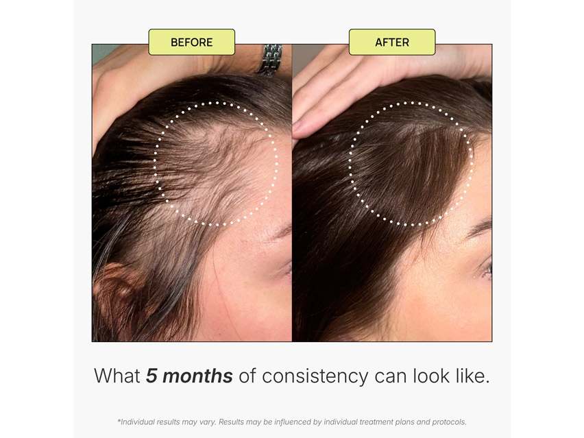 KeraFactor Scalp Stimulating Solution