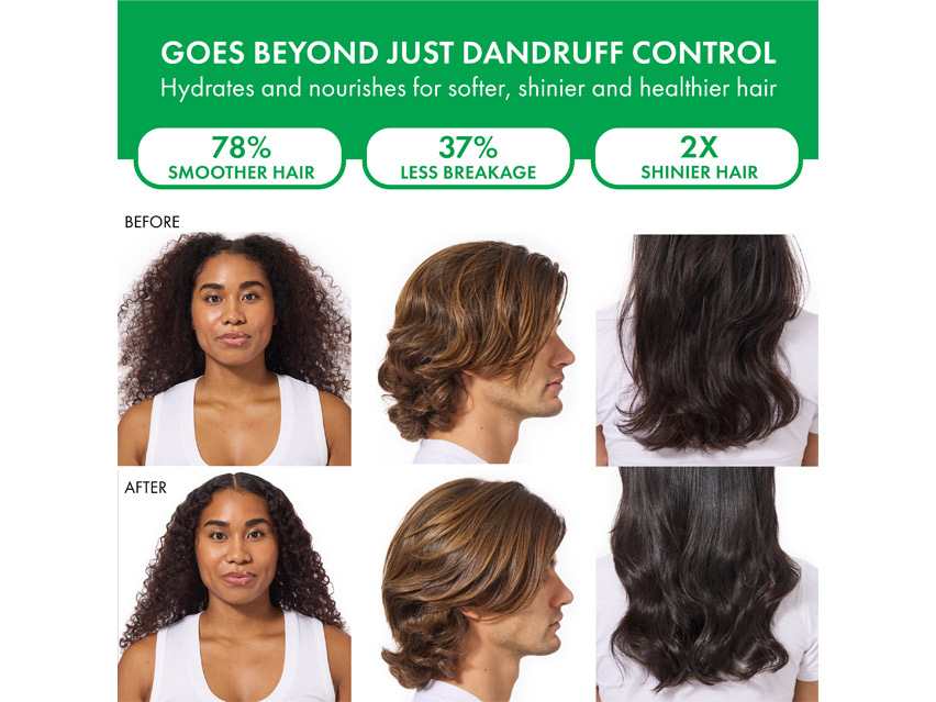 Vichy Dercos Selenium Sulfide Anti-Dandruff Shampoo