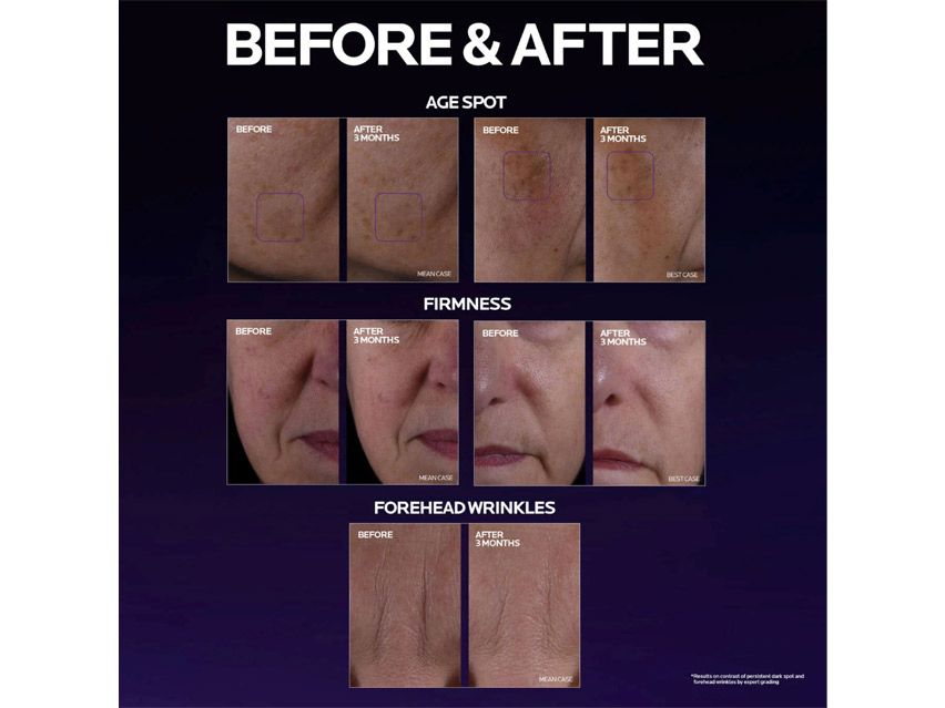 La Roche-Posay MelaB3 Double Dose Day &amp; Night Intensive Treatment