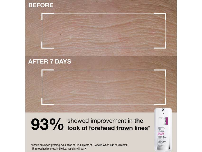StriVectin Anti-Wrinkle Plump, Smooth &amp; Protect Kit - Limited Edition
