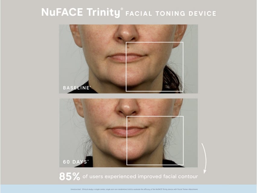 NuFACE Trinity Facial Toning Kit - White