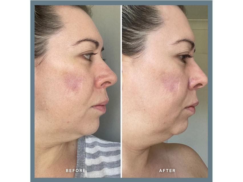 Alpha-H Vitamin A Serum