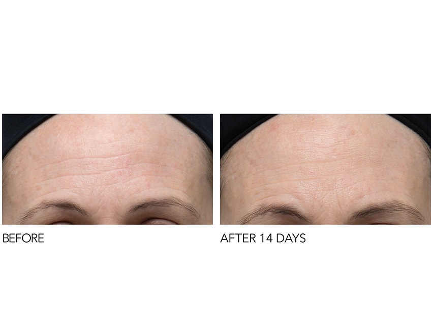 Try out the Dr. Dennis Gross peels that rejuvenate skin.