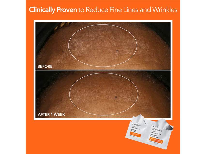 Dr. Dennis Gross Skincare Alpha Beta® Universal Daily Peel