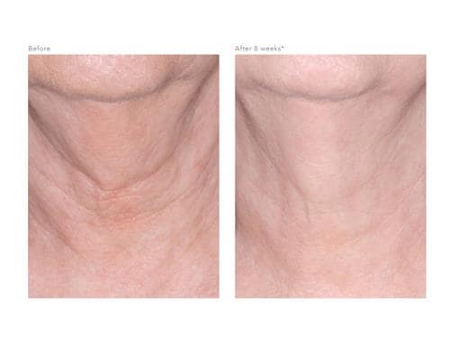 revision skincare nectifirm advanced stores