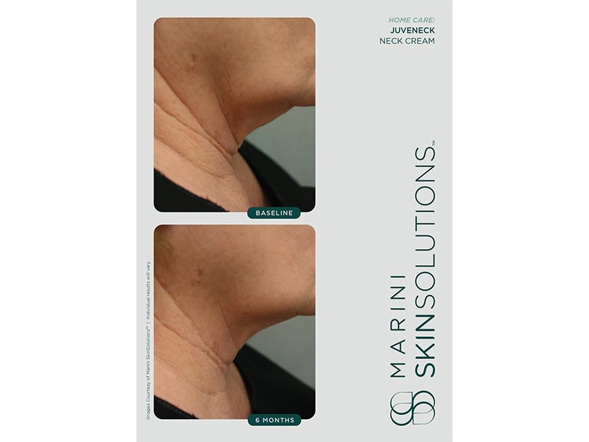 Marini SkinSolutions Marini Juveneck Neck Cream