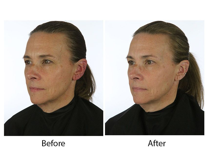 Aramore NAD+ Cell Energizing Treatment