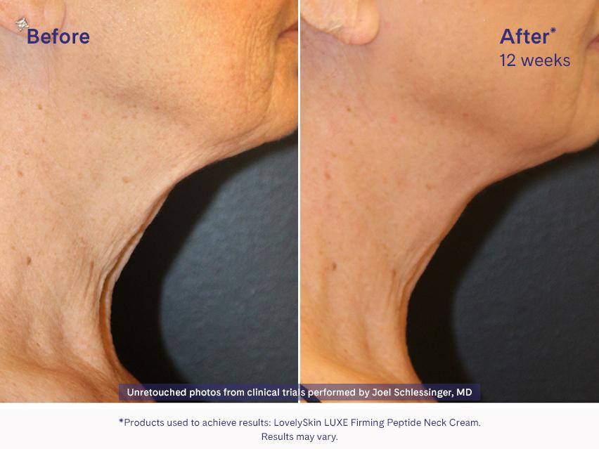 LovelySkin LUXE Firming Peptide Neck Cream