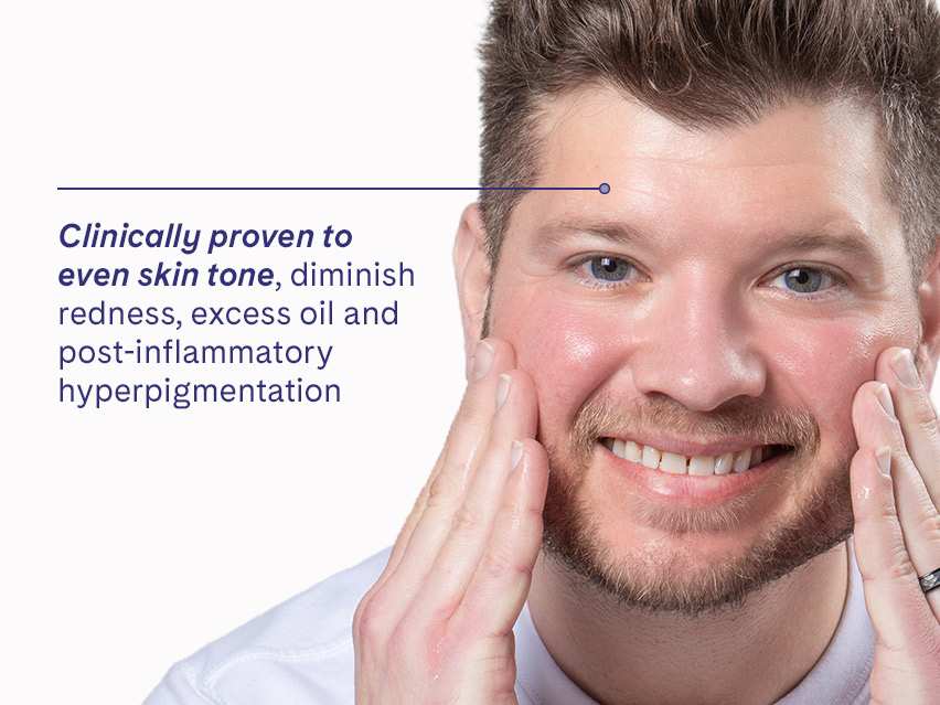 LovelySkin LUXE Acne Care Gel 9%