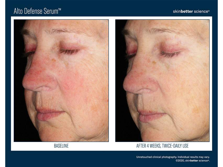 skinbetter science Alto Defense Serum