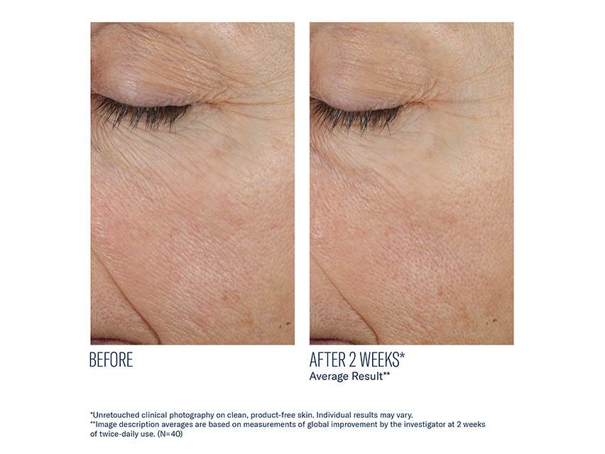 skinbetter science Trio Rebalancing Moisture Treatment