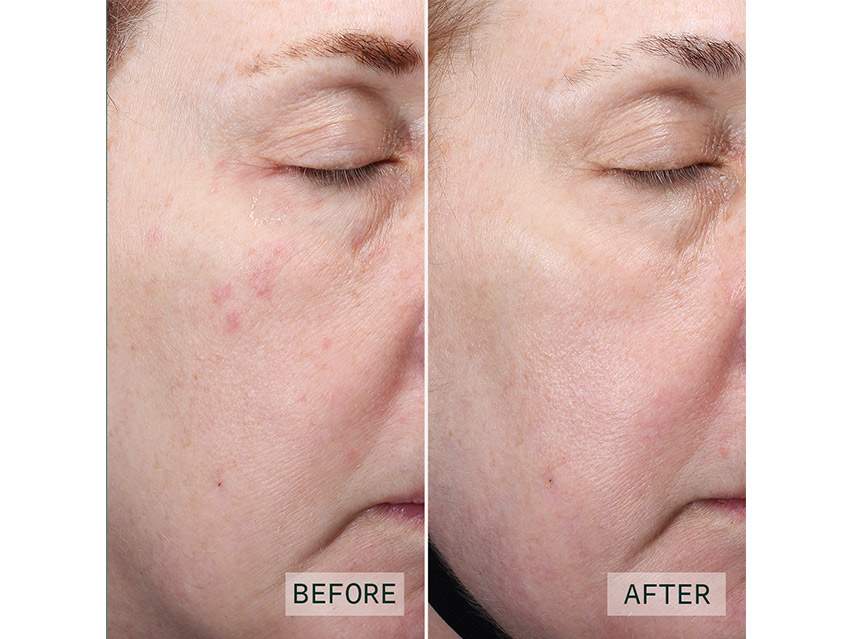 Aramore NAD+ Cell Restoration Cream